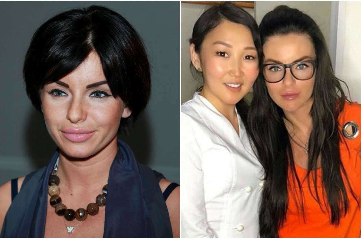 Julia volkova before and after plastics (photo)