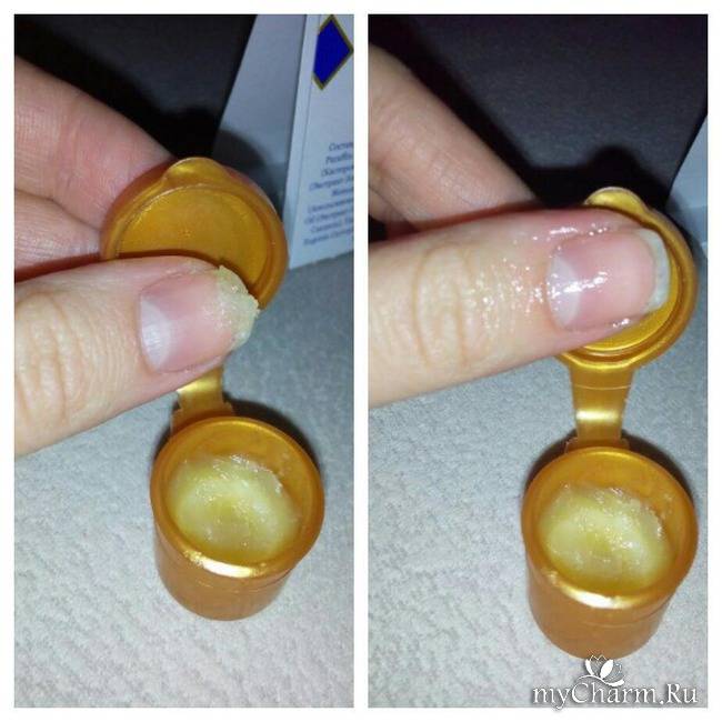 Лечебный маникюр