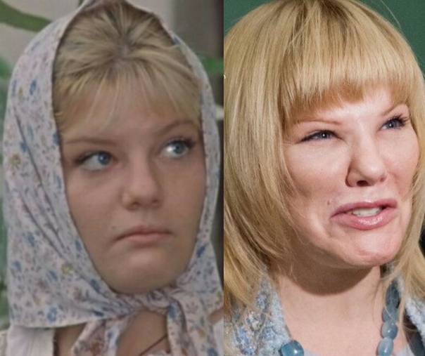 Александра захарова после пластической операции стала моложе: фото до и после пластики