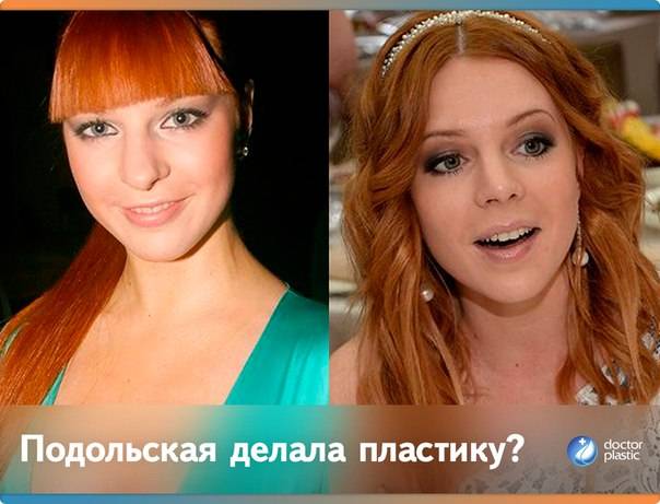 30 знаменитостей до и после пластики лица – 1st-finstep.ru
