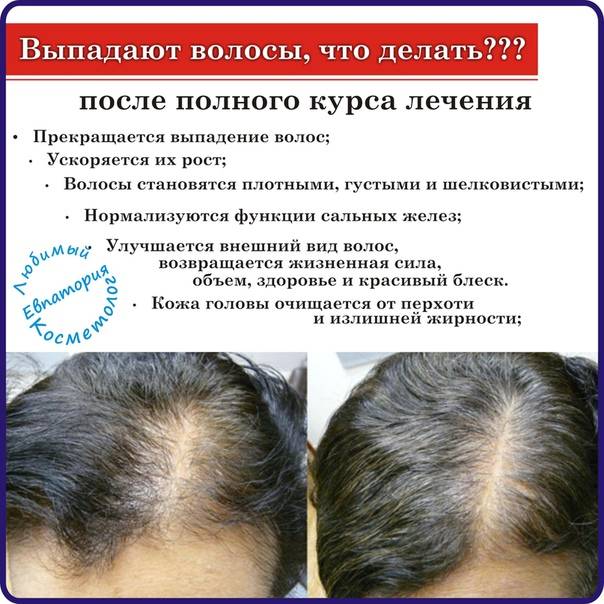 Профессиональное лечение волос - профессиональная косметика и средства