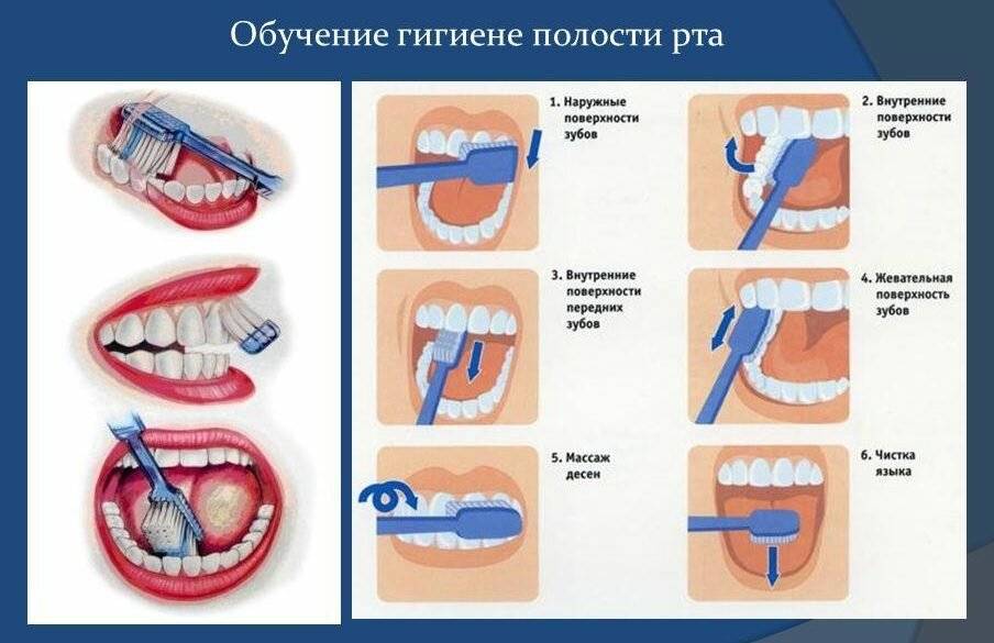 Основы гигиены полости рта