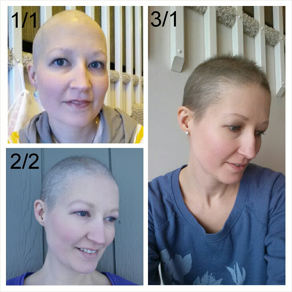 Фото как растут волосы после химиотерапии