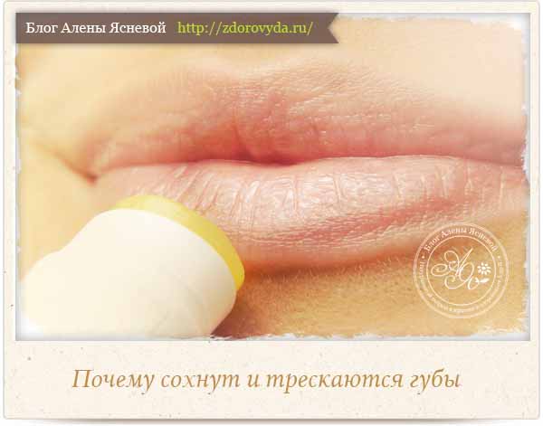 Сухость во рту: причины, лечение - стоматология блеск новосибирск