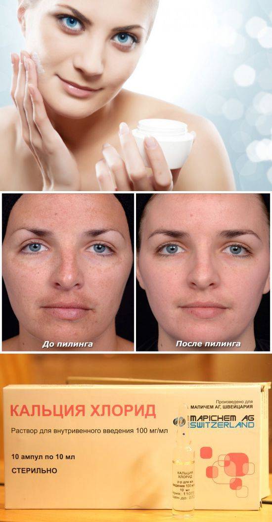 Как ухаживать за кожей после пилинга | лица