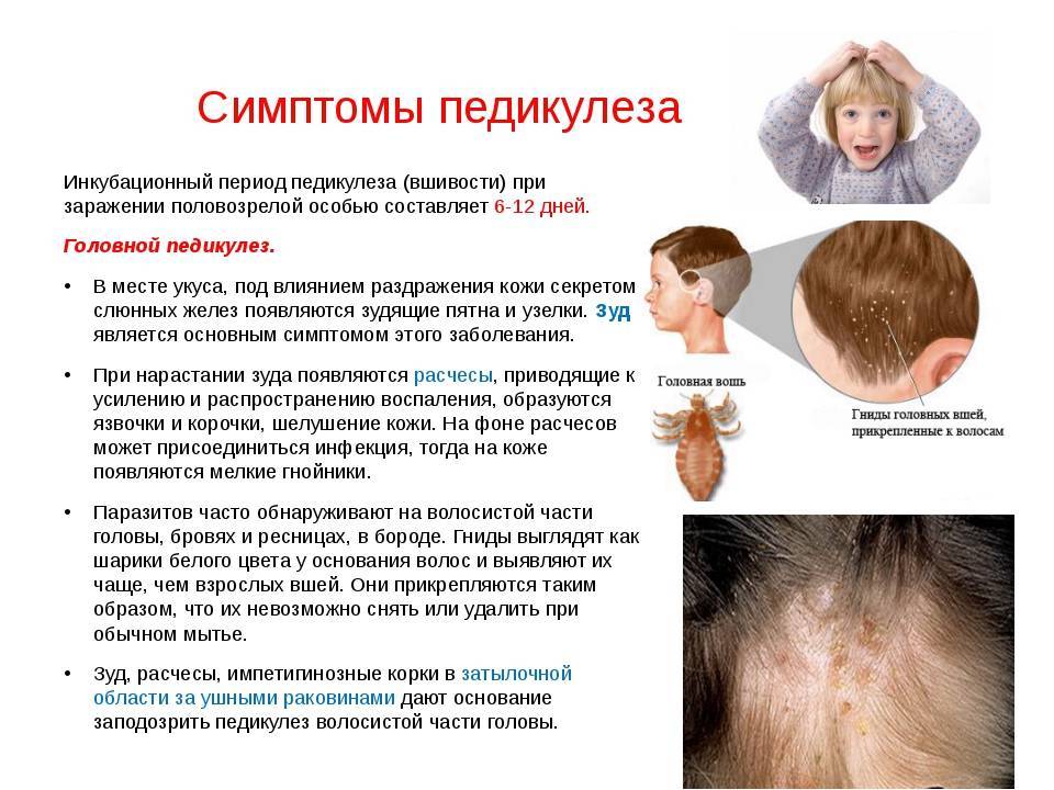 Как избавиться от лишая на лице: особенности разных видов данного заболевания