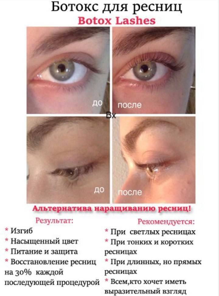 Ботокс ресниц и ламинирование - в чем разница, нюансы, что лучше, советы косметологов, видео