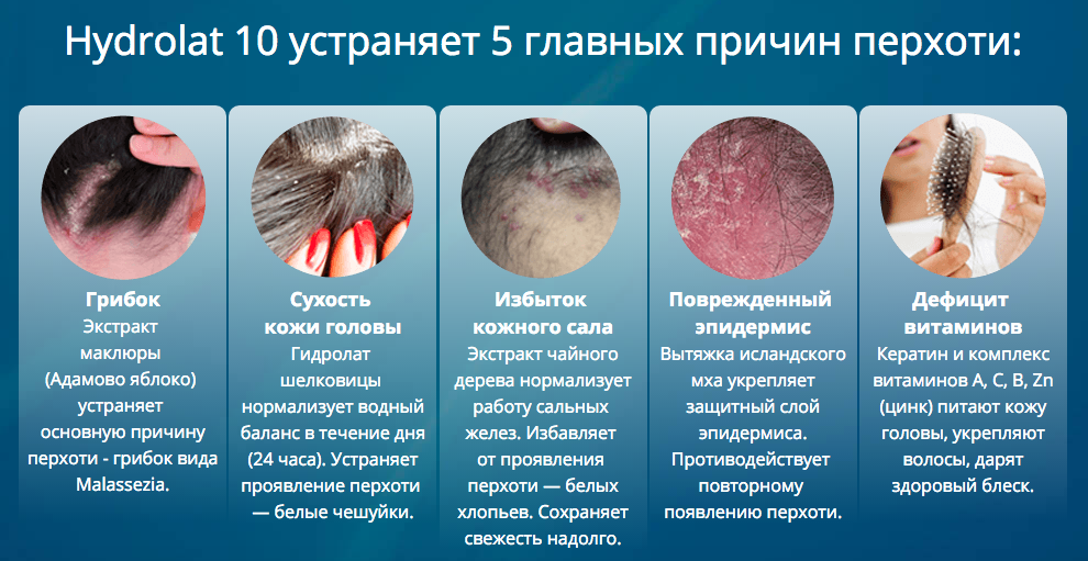 Причины и профилактика себореи кожи головы