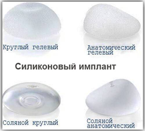 Сравнение круглых и анатомических имплантов