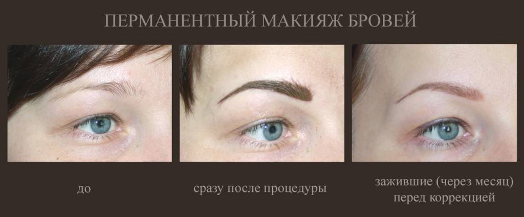 Пудровые брови через год после процедуры – borodadeda.ru