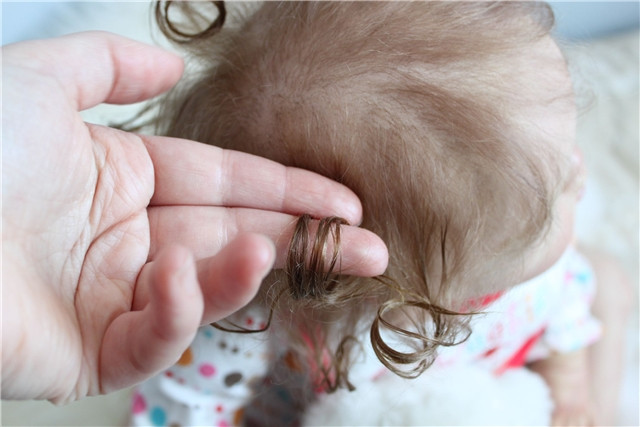 У ребенка выпадают волосы: причины, что делать?