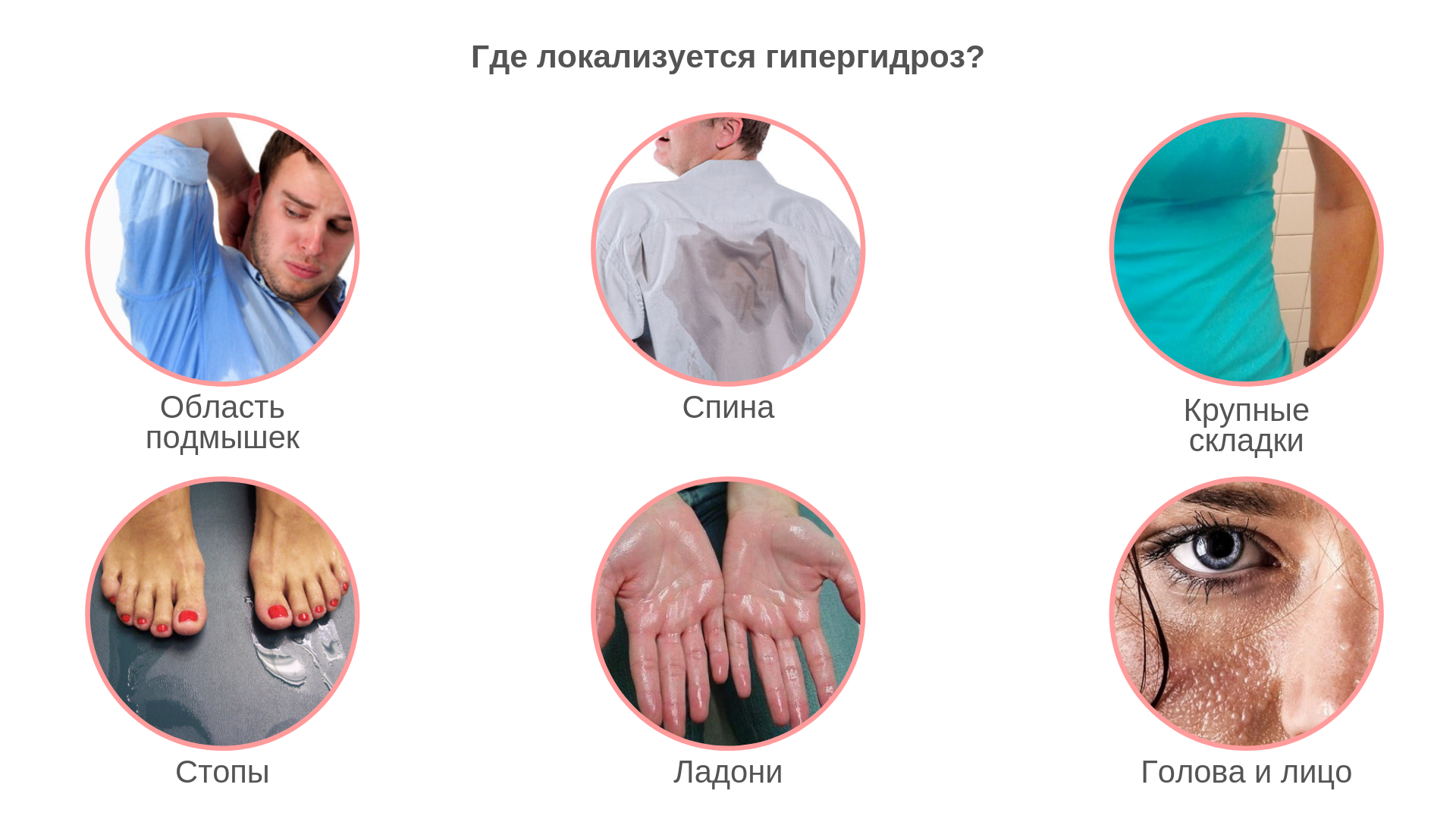 Почему потеют ладони рук – причины у мужчин, женщин, подростков и ребенка, что делать