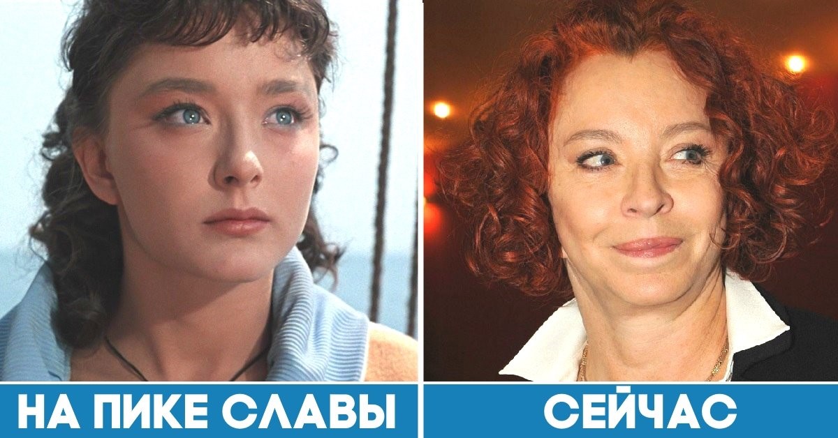 Пластика звезд россии: фото до и после