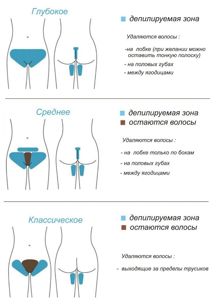 Шугаринг бикини