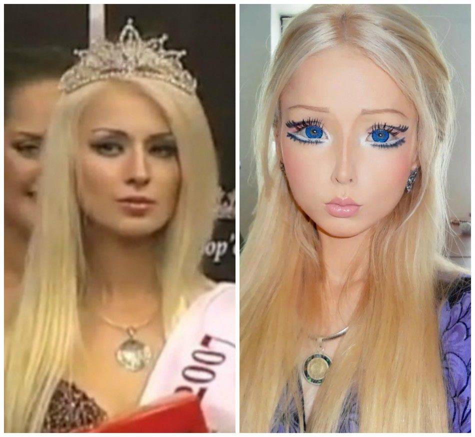 Валерия лукьянова до и после пластики- секреты красоты +фото и биография и видео