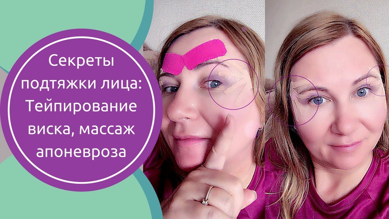 На 10 лет моложе! делаем подтяжку лица пластырем (тейпирование)