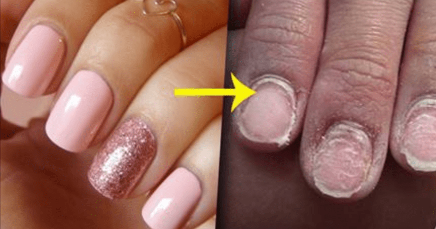 Вреден ли гель лак для ногтей: отзывы