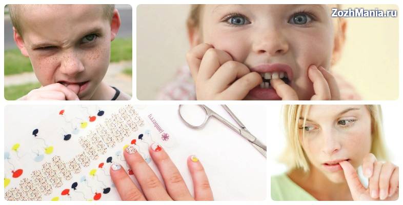 Как отучить ребенка грызть ногти – советы психологов как найти эффективные способы