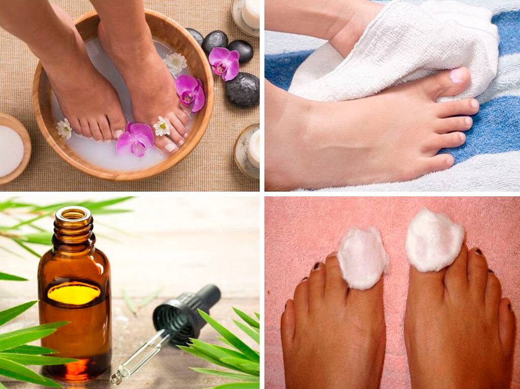 Народные средства от грибка ногтей на ногах - действенные способы и рецепты для домашнего лечения