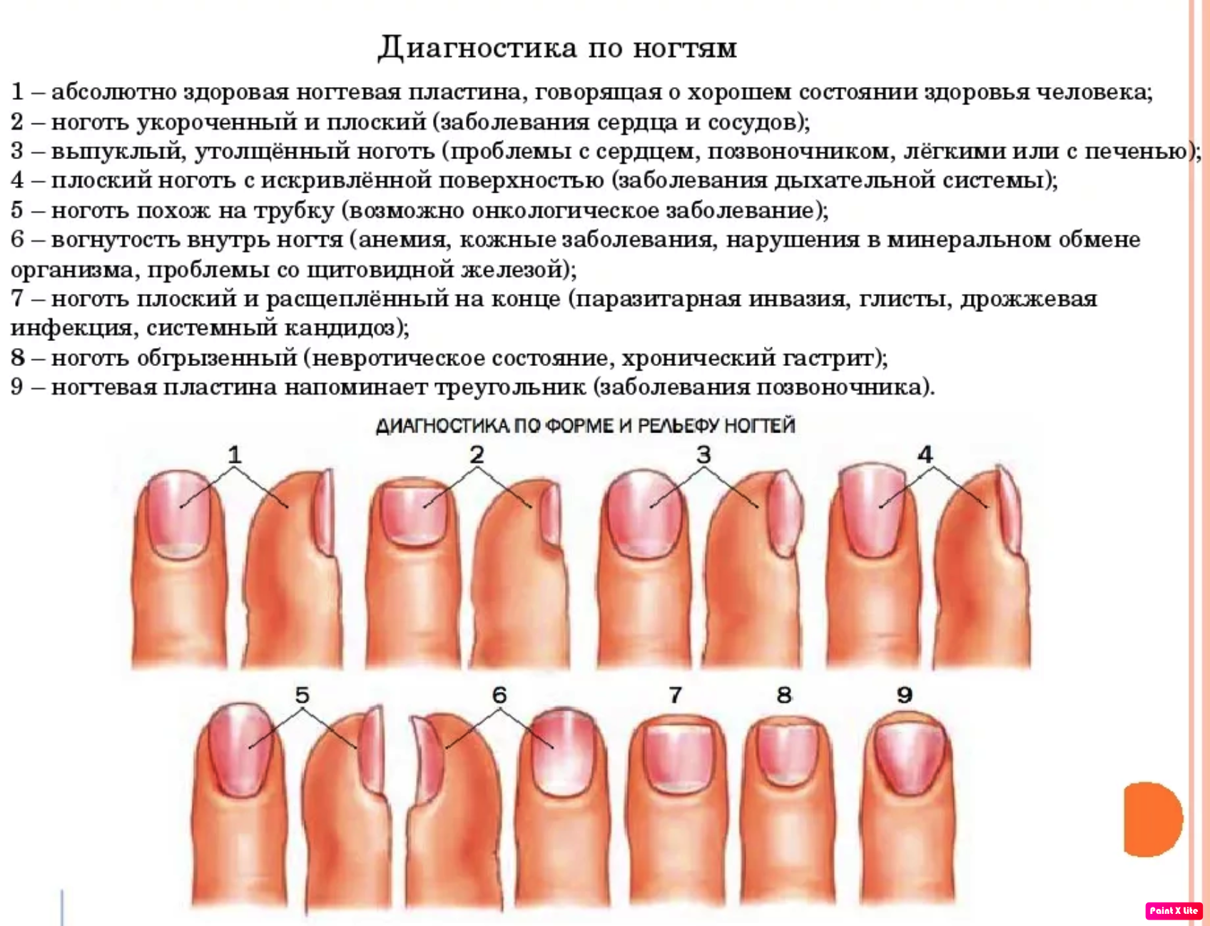 Ногти "сообщают" о диагнозе: когда лунки говорят о проблемах со здоровьем - 5 подсказок