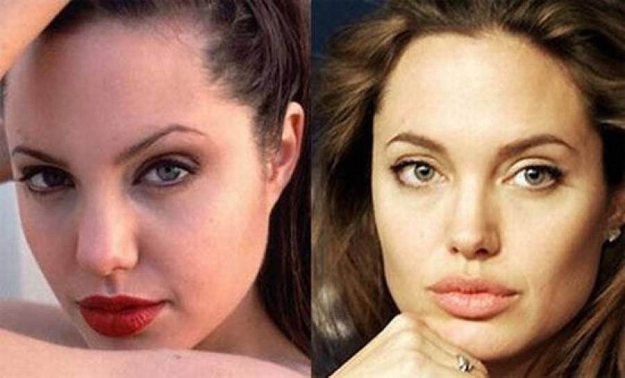 Анджелина джоли до и после пластических операций (+ фото)