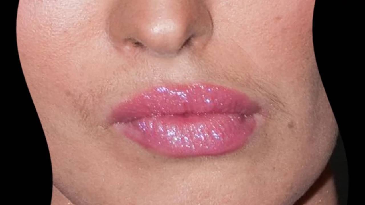 Морщины вокруг губ
