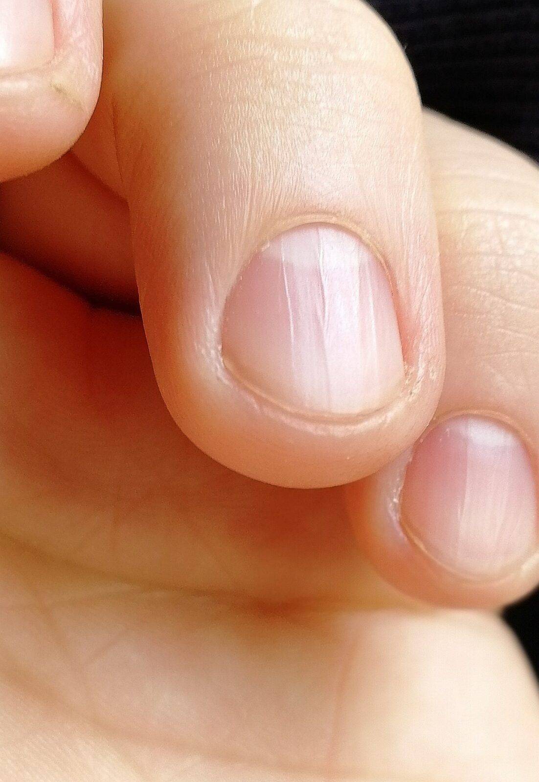 С какой скоростью растут ногти? почему ногти растут быстро?