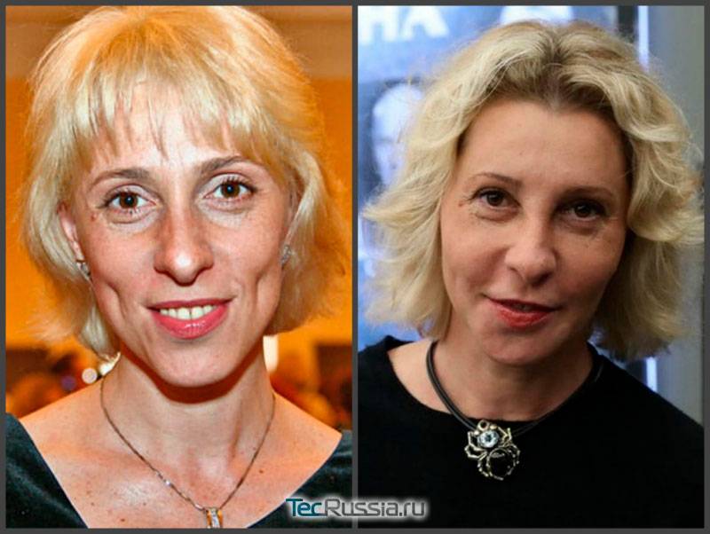 Юлия рутберг до и после пластики лица – фото 2017-2019 года и вся правда об операциях актрисы