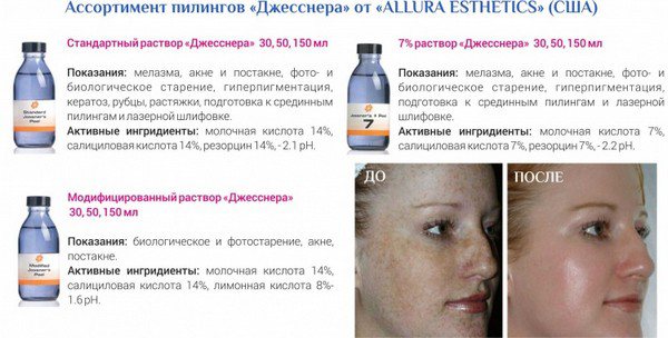 Химический пилинг кожи лица и тела