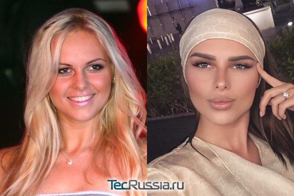 Ханна до и после пластики – фото певицы и биография | ddick.ru