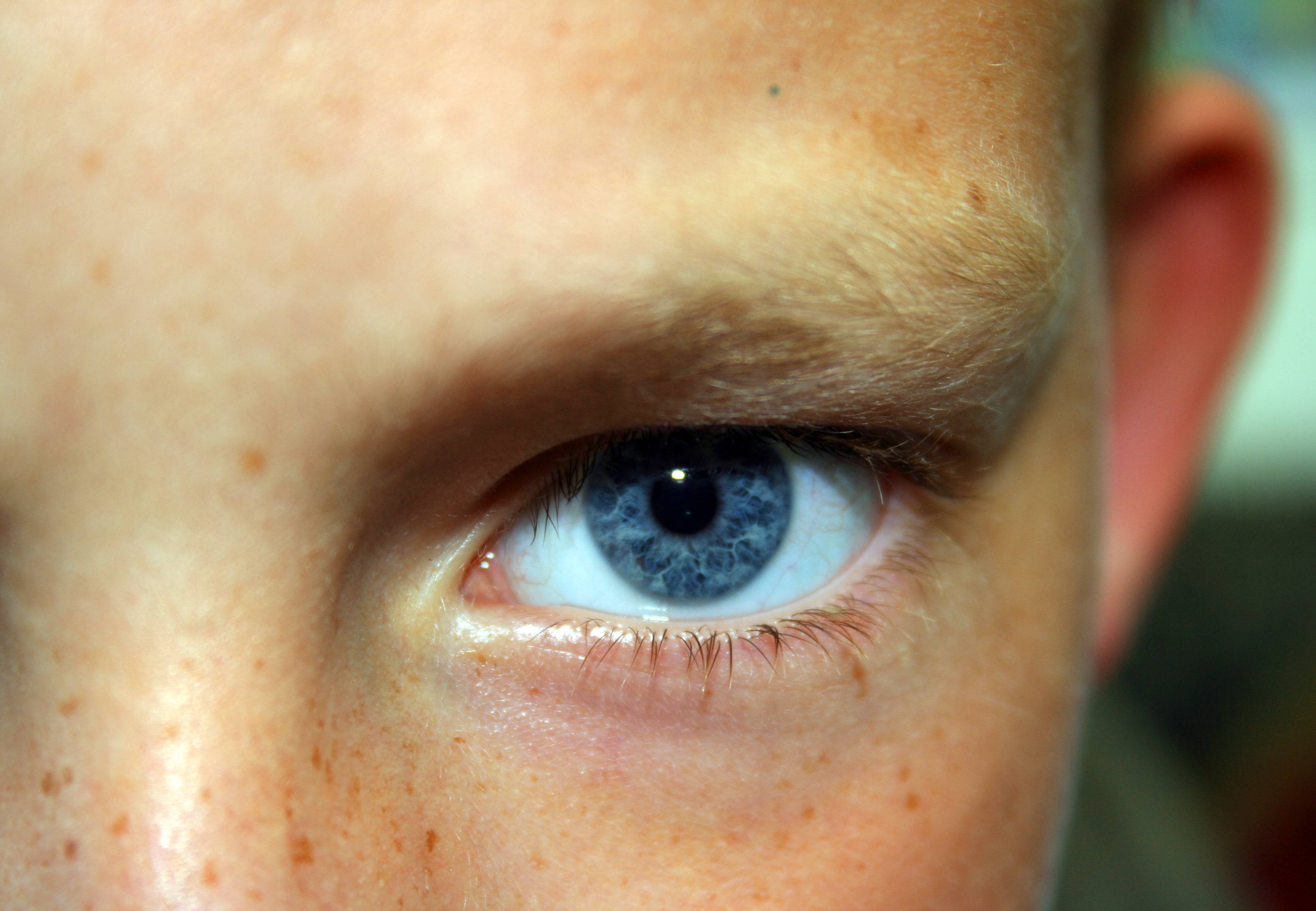 Красный глаз у ребенка: причины и способы лечения