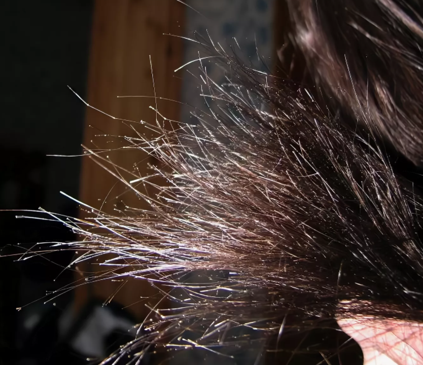 Выпадают волосы секутся. Сеченые кончики волос. Секущиеся волосы. Секущиеся кончики волос. Посеченные концы волос.