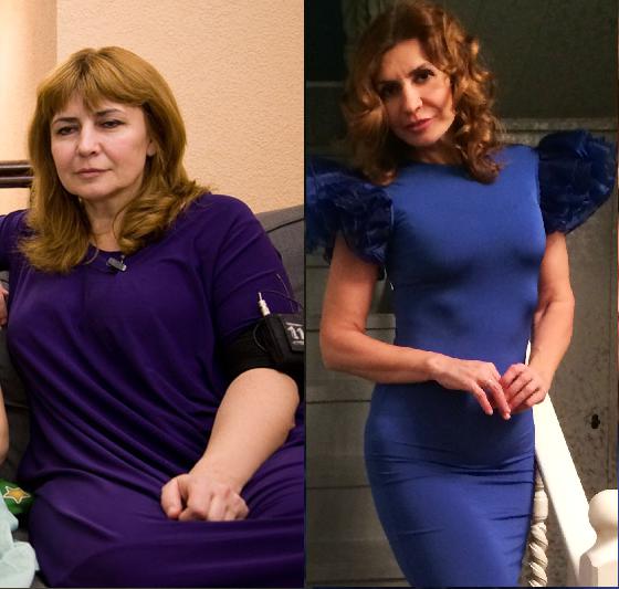 Ирина Агибалова. Фото до и после операции, похудения