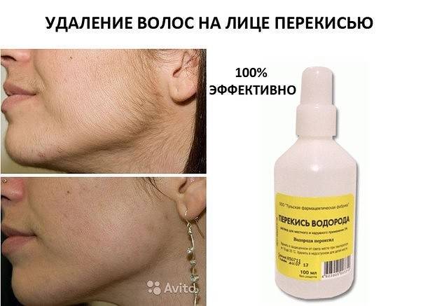 Как использовать соду для удаления нежелательных волос?