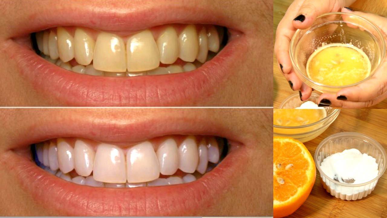 отбеливание зубов маслом лимона