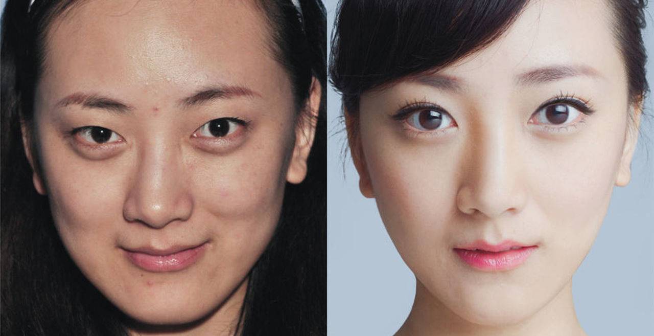 Азиатки до и после операции