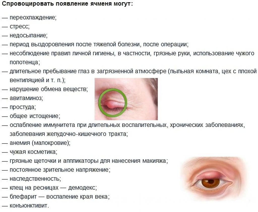 Ячмень. диагностика и лечение