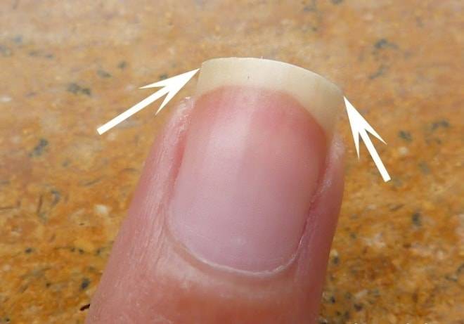 Как сделать квадратную форму ногтей? квадратная форма ногтей - фото