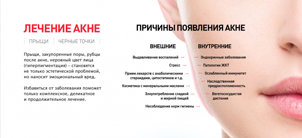 Как убрать морщины на лбу