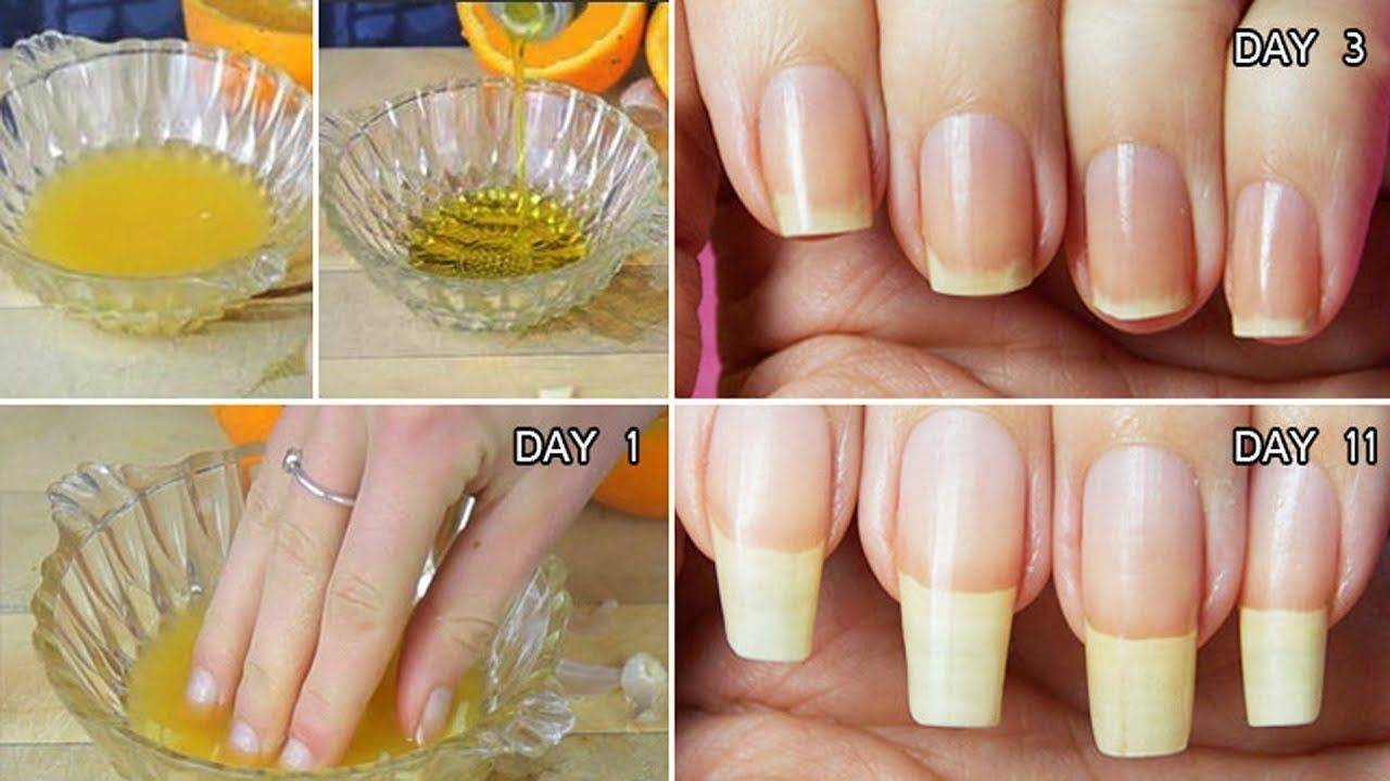Как отрастить ногти за неделю