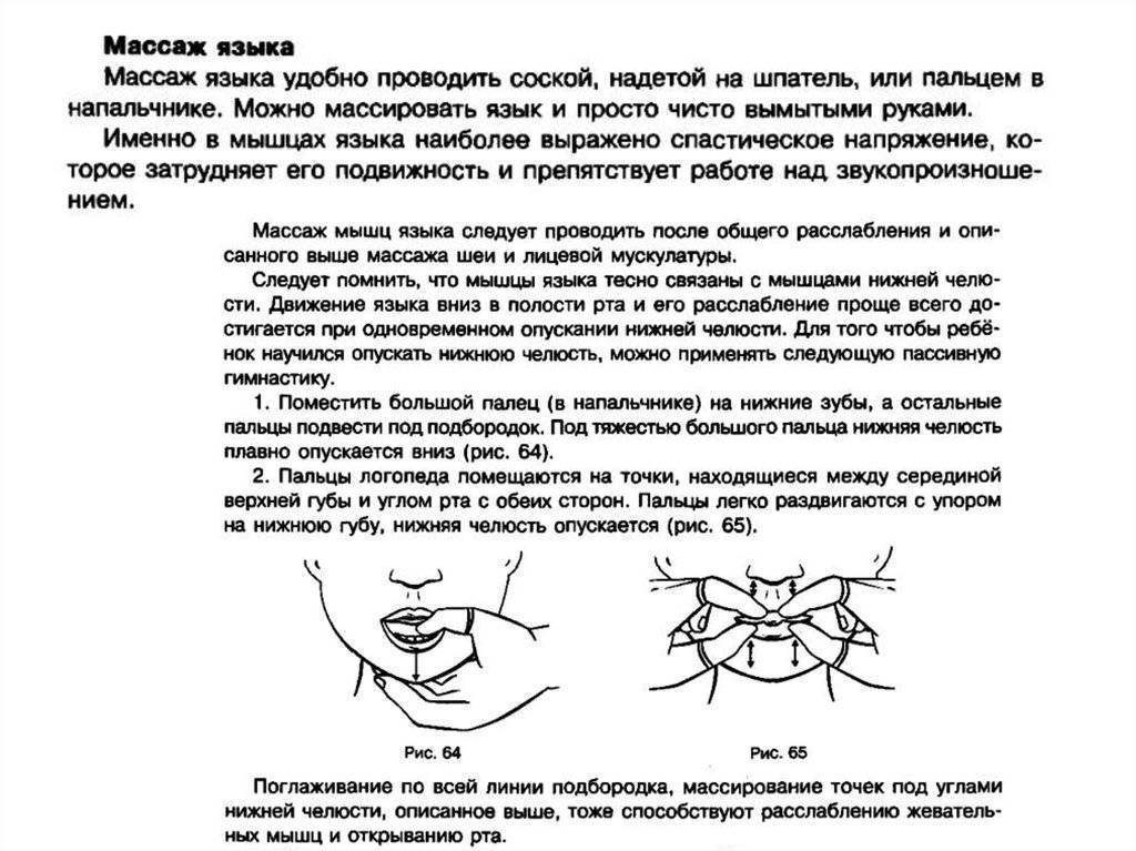 Логомассаж при дизартрии схема последовательность в домашних условиях