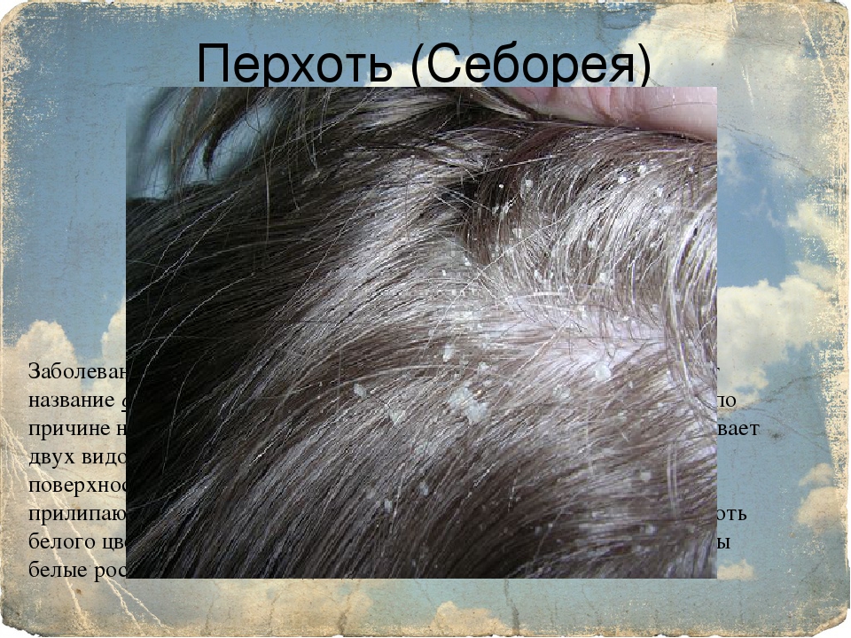 Перхоть на бороде у мужчин: причины и методы лечения – dorco.ru