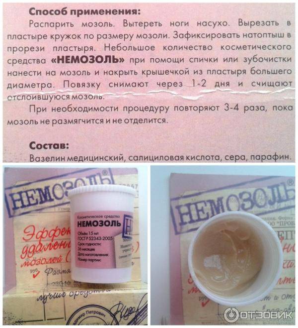 Нет мозолям на ногах! Список лучших мазей и инструкции по их применению