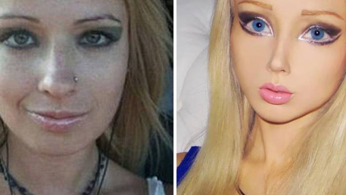 Валерия лукьянова, фото до и после операции девушки барби (amatue 21)