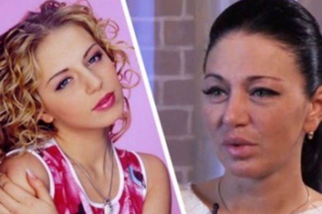 Алекса: пластика певицы, результаты для носа, губ до и после | marykay-4u.ru