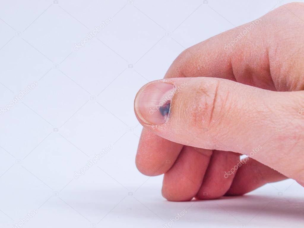 Мышечная слабость