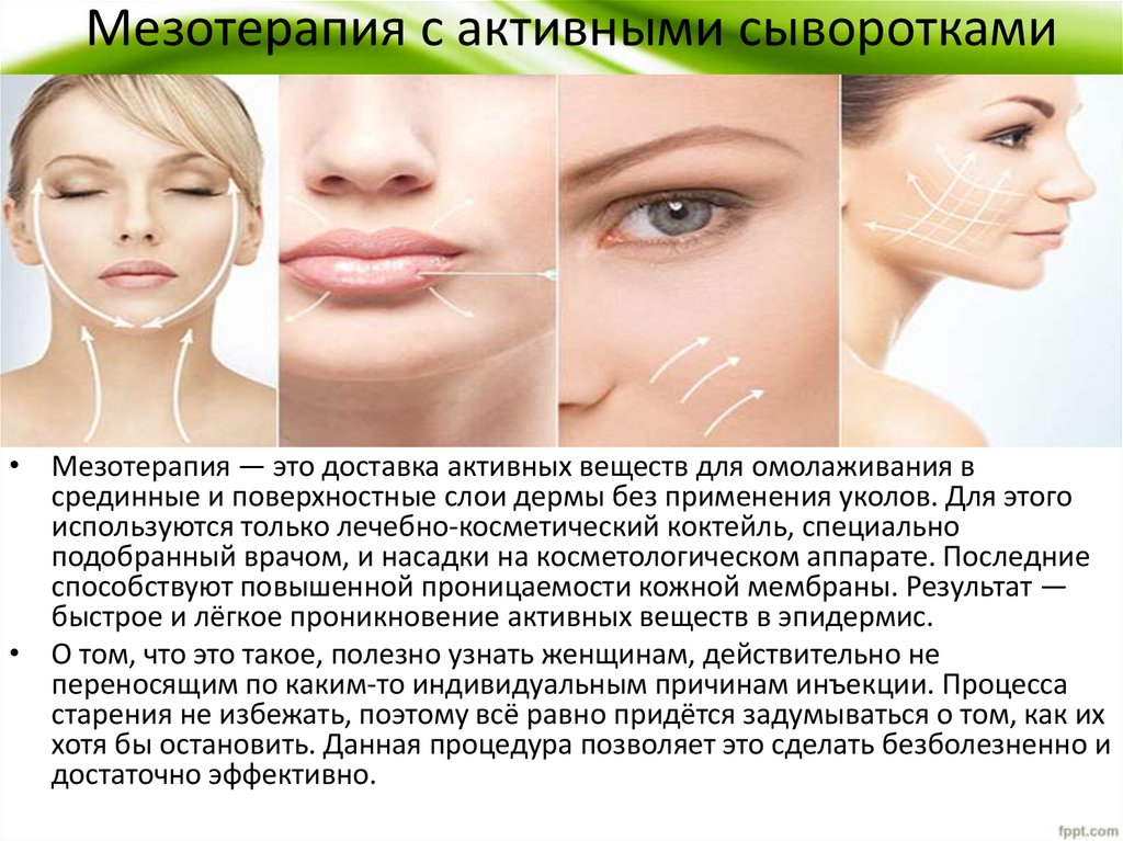 Мезотерапия - техники проведения и виды