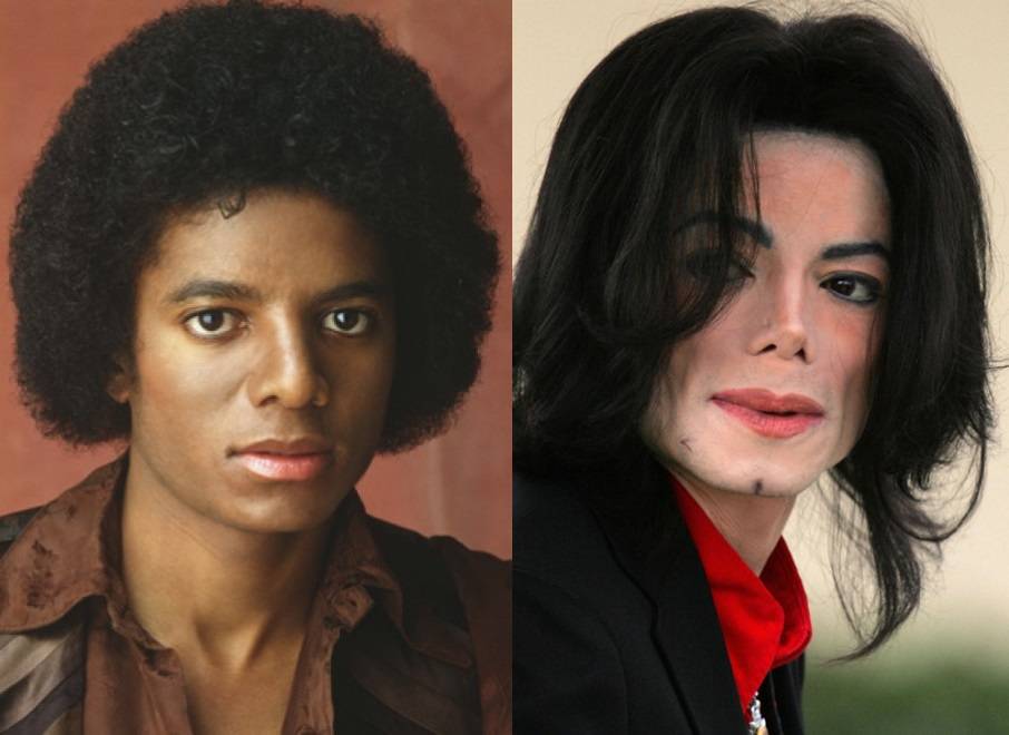 Майкл Джексон: пластика «по-королевски»