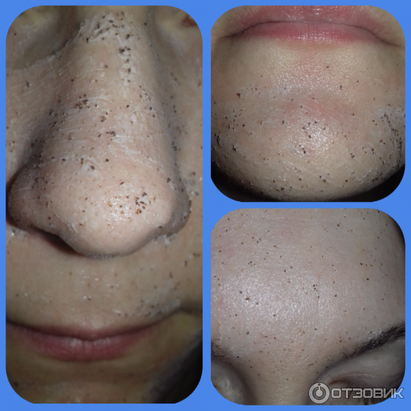 Правильное очищение кожи лица: этапы ухода за кожей