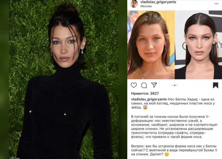 Белла хадид (bella hadid) – биография, фото, рост и вес, личная жизнь, параметры, возраст 2021